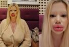 This girl spent $26,000 just on lip enhancement and became the woman with the biggest lips 😲 In addition, she changed her cheekbones, jawline, and chin 😱 Due to the many surgeries, she had trouble eating, speaking, or even smiling 😨 But even those difficulties didn’t stop her — she recently underwent several more changes 😱 The most surprising part is that she used to be a very beautiful girl with stunning natural looks 😢 A photo of her before all the plastic procedures was posted in the first comment ⬇️⬇️