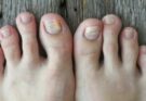 10 Ways Your Feet Are Telling You Something About Your Health