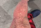 These are the consequences of sleeping wi…See more
