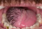 These are the consequences of sleeping with…See more