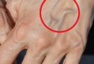 If you have visible veins, it means you are… See more 👇