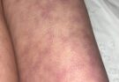 These are the consequences of sleeping with the… See moree